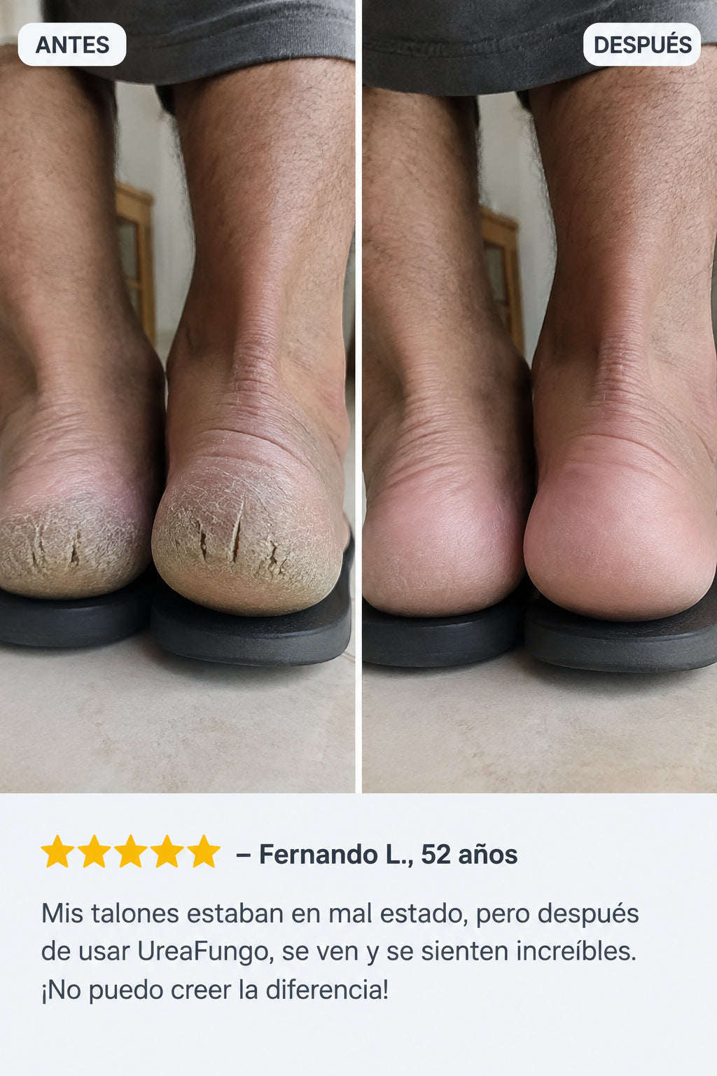 UreaFungo - Cuidado de Pies Anti Hongos
